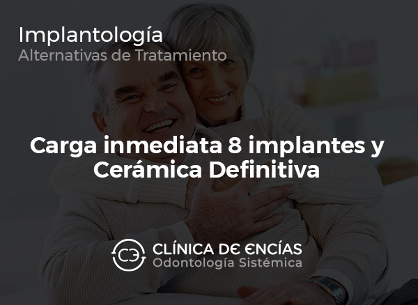 Carga Inmediata 8 Implantes y Cerámica Definitiva